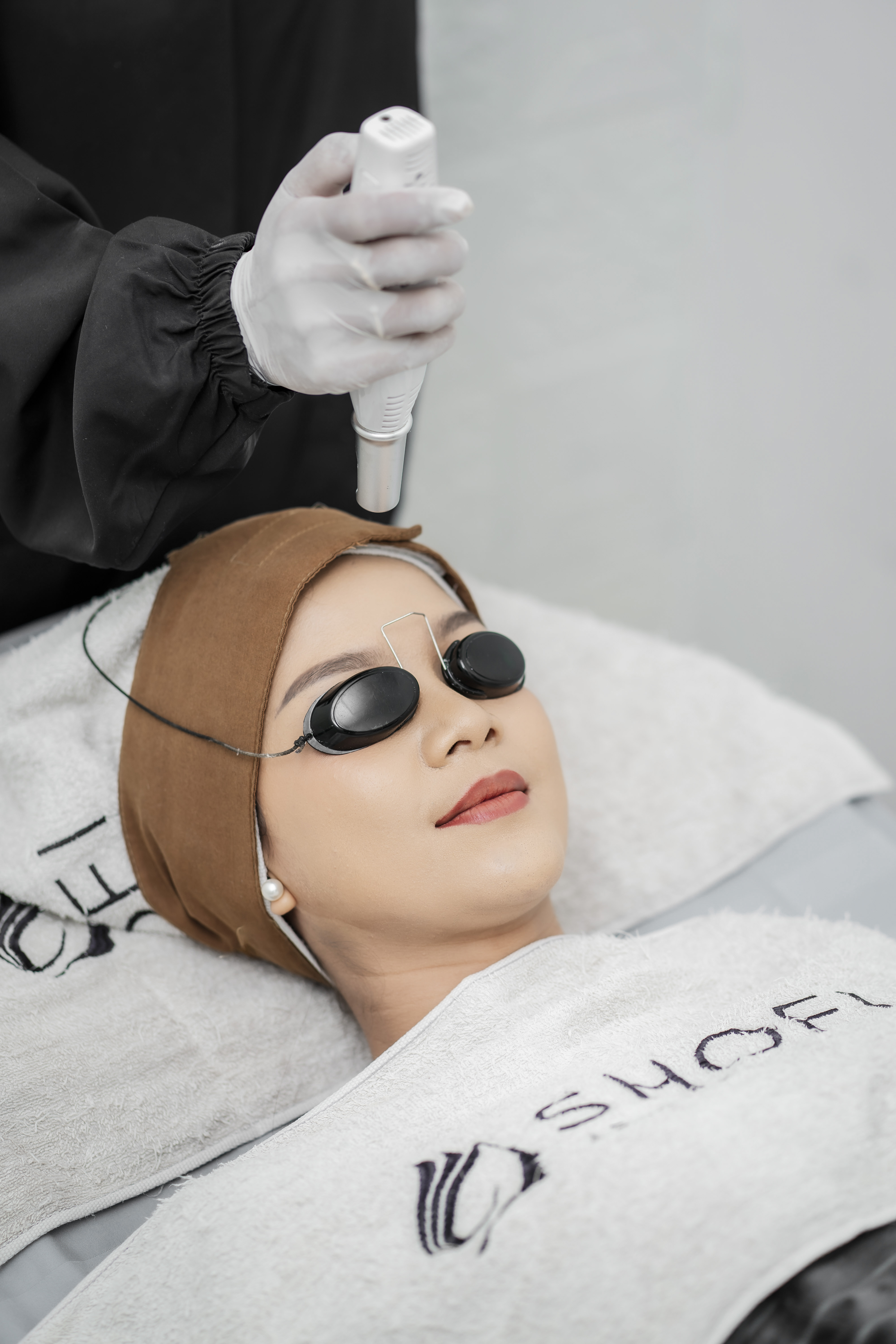 Blue Laser For Acne